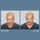 XFusion Keratin Hair Fibers